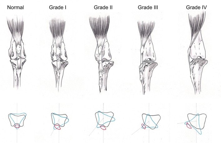 Stages of Patella Luxation in Dogs